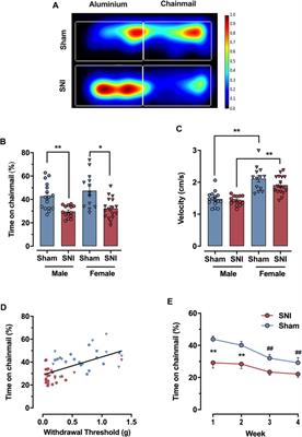 Quantification of stimulus-evoked tactile allodynia in free moving mice by the chainmail sensitivity test